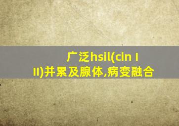 广泛hsil(cin III)并累及腺体,病变融合